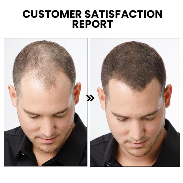 Thailand hair growth spray (Limited time offer 🔥Last day)-unitmotor™