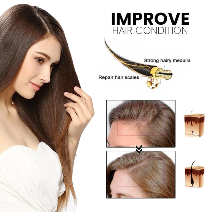 Thailand hair growth spray (Limited time offer 🔥Last day)-unitmotor™