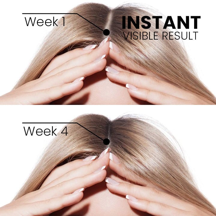 Thailand hair growth spray (Limited time offer 🔥Last day)-unitmotor™