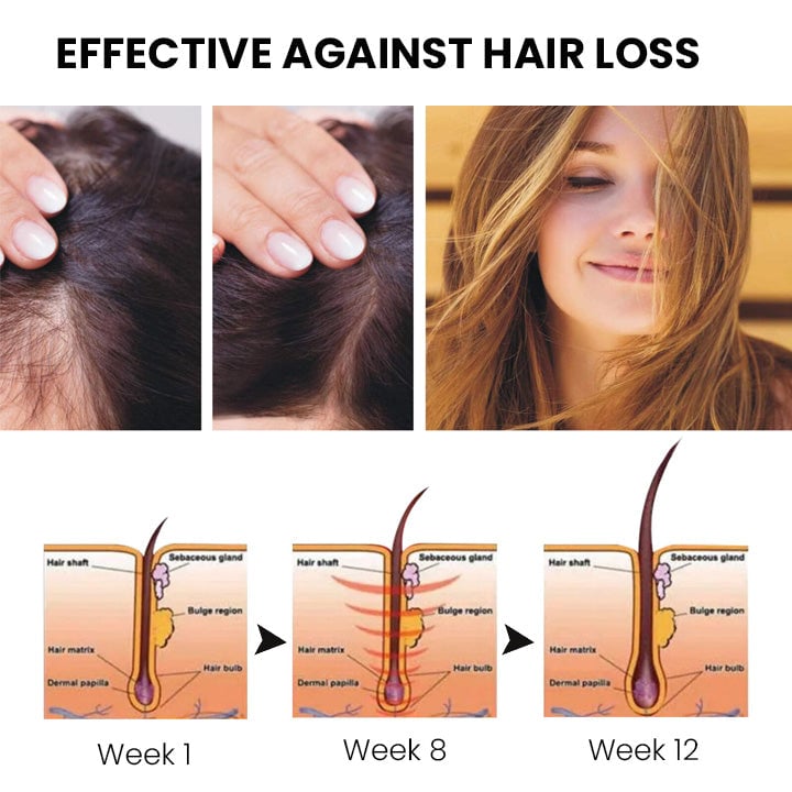 Thailand hair growth spray (Limited time offer 🔥Last day)-unitmotor™
