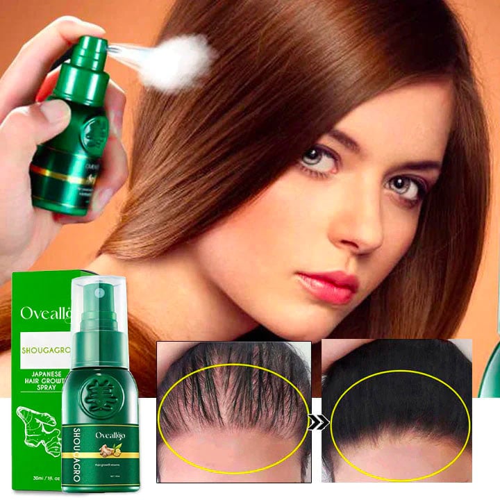 Thailand hair growth spray (Limited time offer 🔥Last day)-unitmotor™