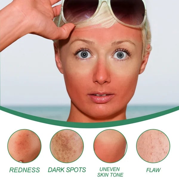 š„Hot Sale-49% OFF š„Color Correcting Treatment Cream-unitmotorā¢