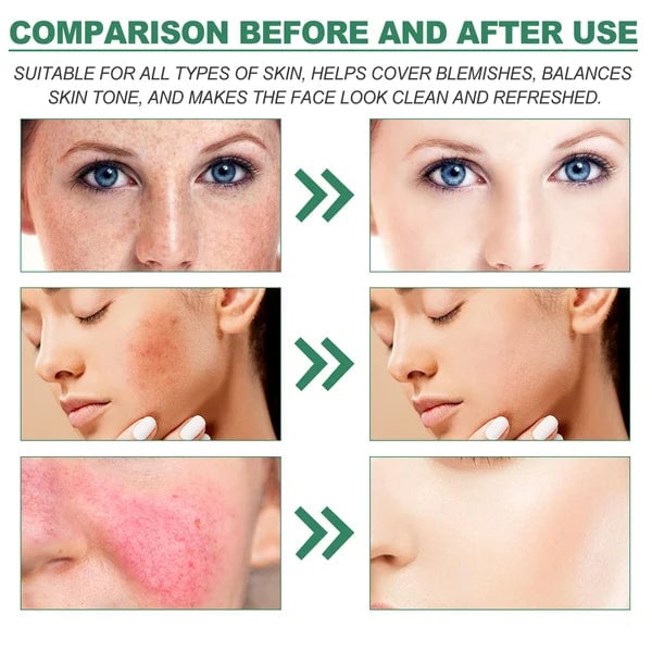 š„Hot Sale-49% OFF š„Color Correcting Treatment Cream-unitmotorā¢