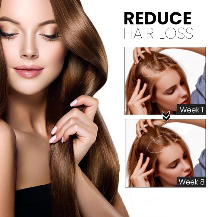 Thailand hair growth spray (Limited time offer 🔥Last day)-unitmotor™